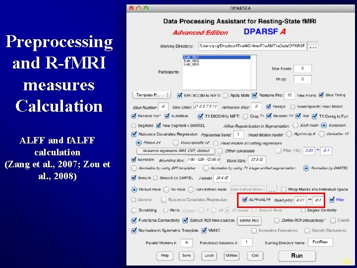 Preprocessing and R-f. MRI measures Calculation ALFF and f. ALFF calculation (Zang et al.