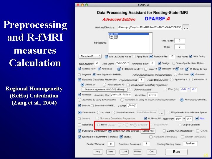 Preprocessing and R-f. MRI measures Calculation Regional Homogeneity (Re. Ho) Calculation (Zang et al.