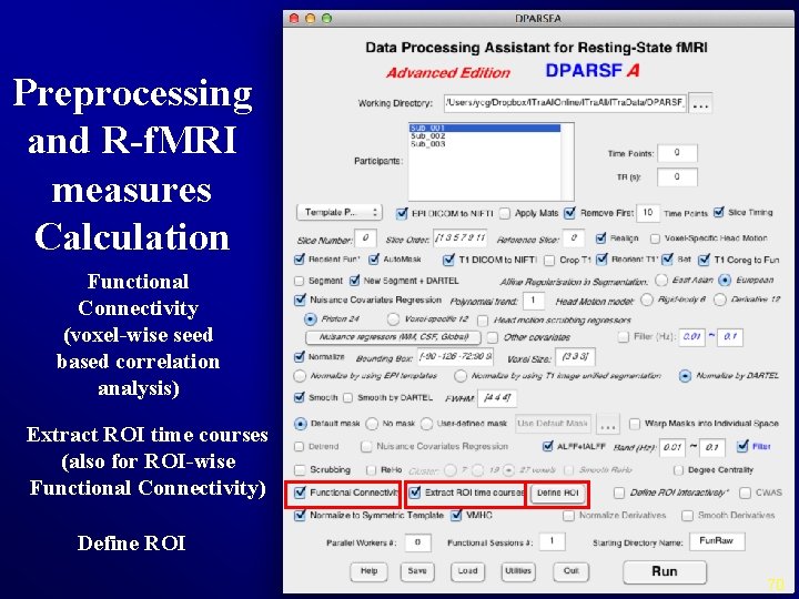 Preprocessing and R-f. MRI measures Calculation Functional Connectivity (voxel-wise seed based correlation analysis) Extract