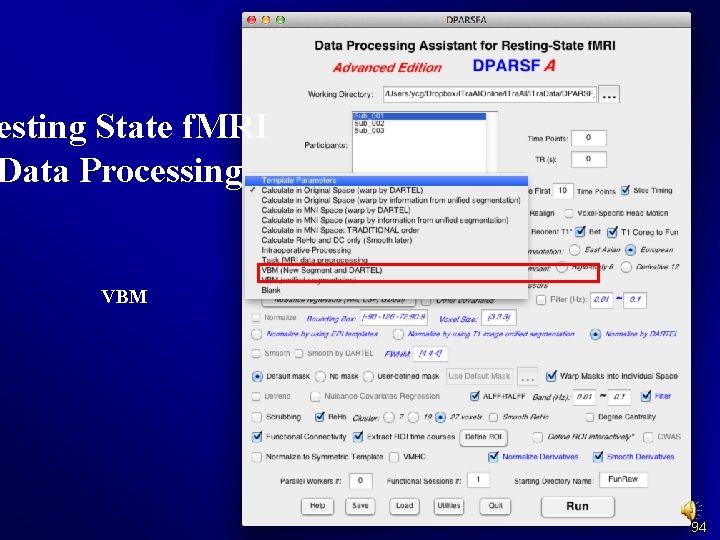 esting State f. MRI Data Processing VBM 94 