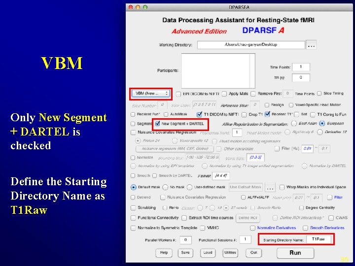 VBM Only New Segment + DARTEL is checked Define the Starting Directory Name as