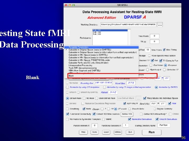 esting State f. MRI Data Processing Blank 96 