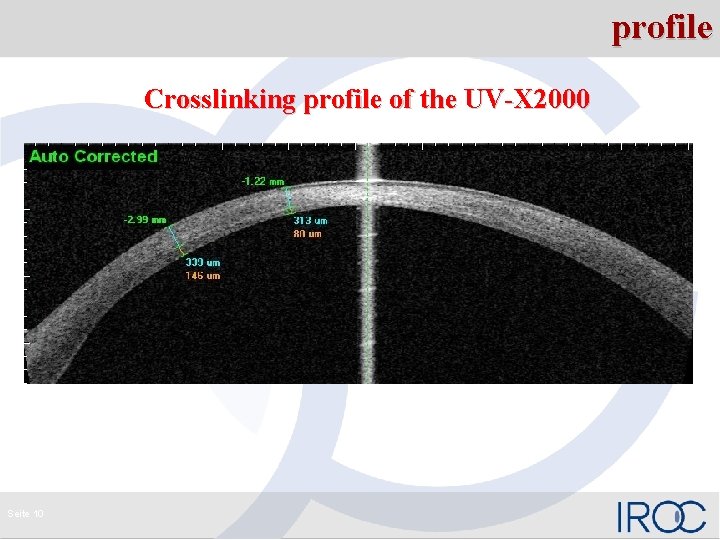 profile Crosslinking profile of the UV-X 2000 Seite 10 