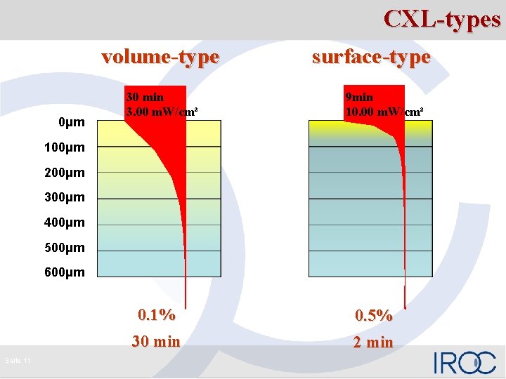 CXL-types volume-type 0μm 30 min 3. 00 m. W/cm² surface-type 9 min 10. 00