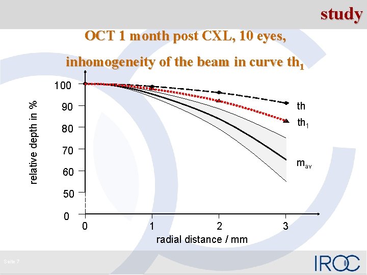 study OCT 1 month post CXL, 10 eyes, inhomogeneity of the beam in curve