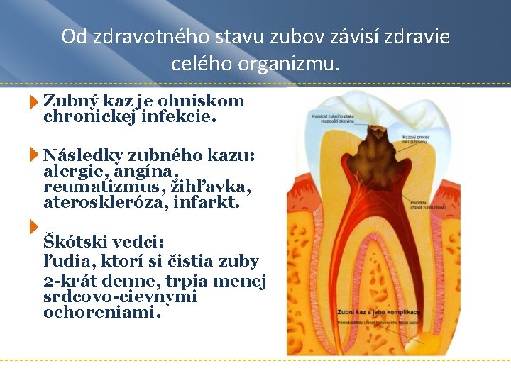 Od zdravotného stavu zubov závisí zdravie celého organizmu. Zubný kaz je ohniskom chronickej infekcie. Od zdravotného stavu zubov závisí zdravie celého organizmu. Zubný kaz je ohniskom chronickej infekcie.