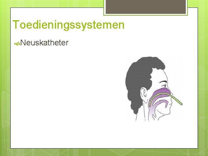 Toedieningssystemen Neuskatheter Toedieningssystemen Neuskatheter