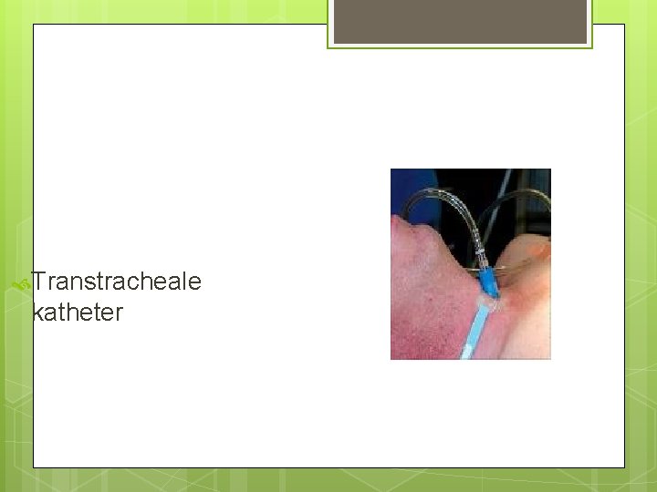 Transtracheale katheter Transtracheale katheter