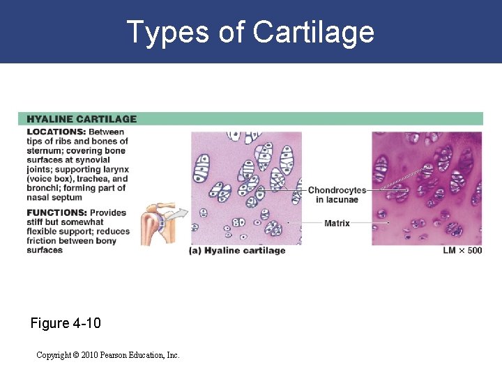 Types of Cartilage Figure 4 -10 Copyright © 2010 Pearson Education, Inc. 