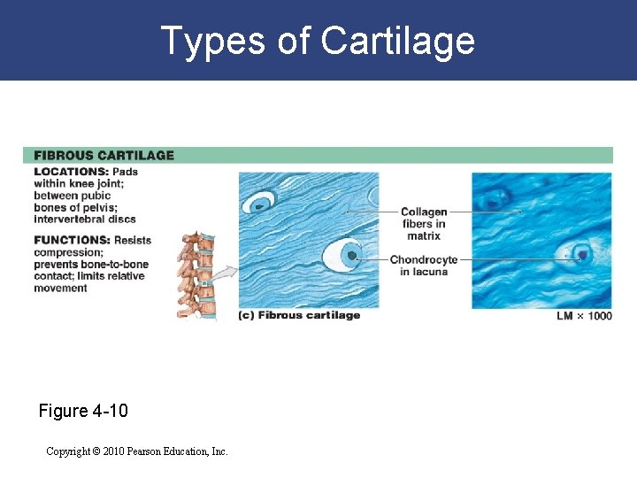 Types of Cartilage Figure 4 -10 Copyright © 2010 Pearson Education, Inc. 