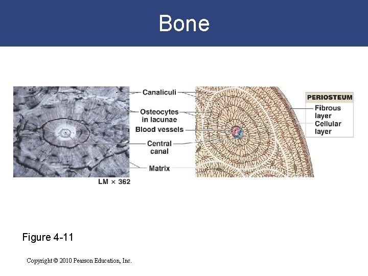 Bone Figure 4 -11 Copyright © 2010 Pearson Education, Inc. 