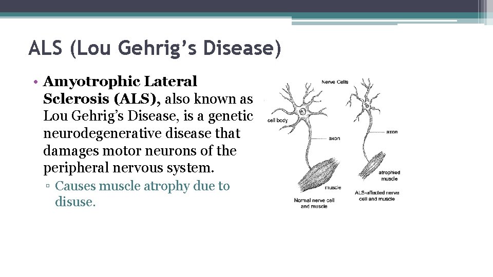 ALS (Lou Gehrig’s Disease) • Amyotrophic Lateral Sclerosis (ALS), also known as Lou Gehrig’s