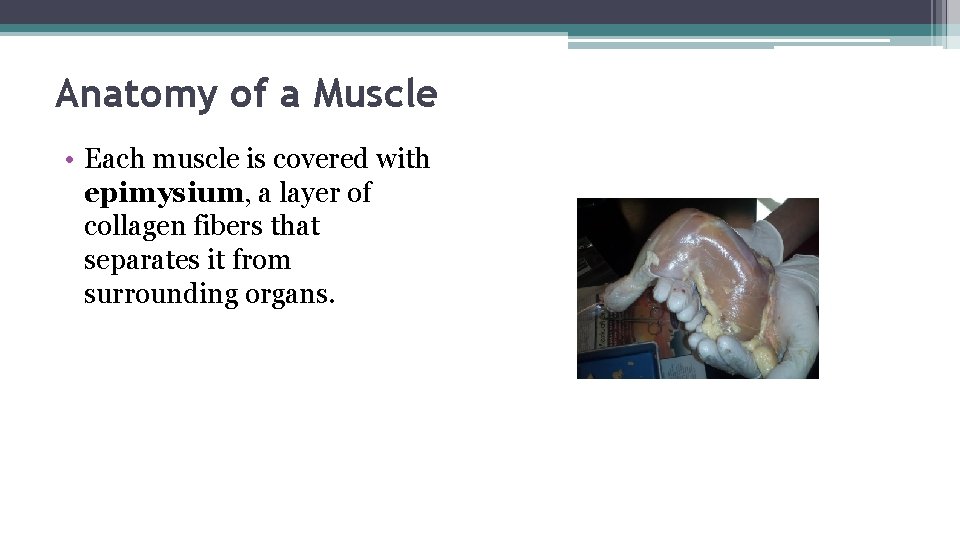 Anatomy of a Muscle • Each muscle is covered with epimysium, a layer of