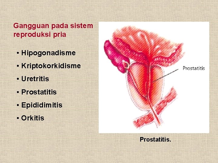 Gangguan pada sistem reproduksi pria • Hipogonadisme • Kriptokorkidisme • Uretritis • Prostatitis •