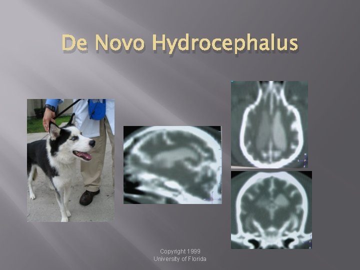 De Novo Hydrocephalus Copyright 1999 University of Florida 