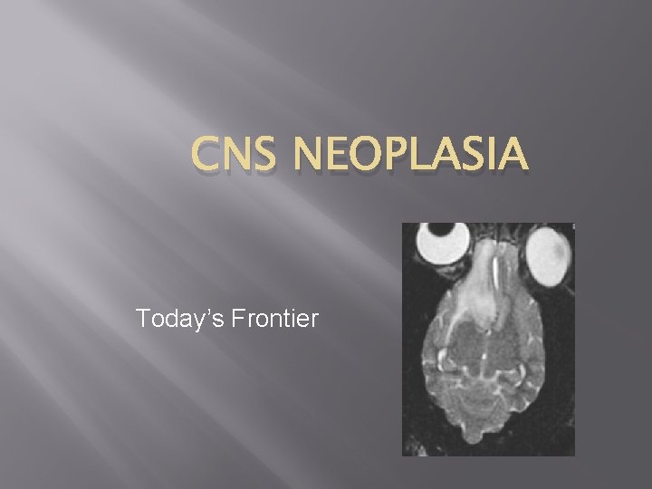 CNS NEOPLASIA Today’s Frontier 