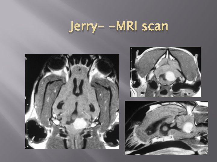 Jerry- -MRI scan 