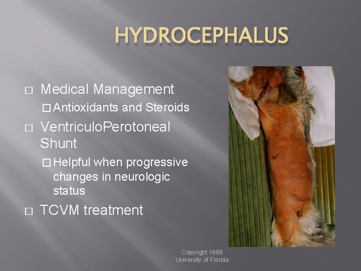 HYDROCEPHALUS � Medical Management � Antioxidants � and Steroids Ventriculo. Perotoneal Shunt � Helpful