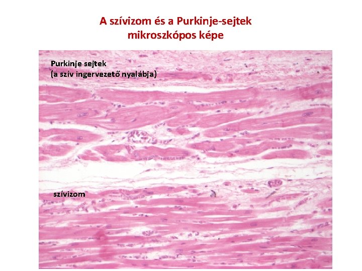 A szívizom és a Purkinje-sejtek mikroszkópos képe Purkinje sejtek (a szív ingervezető nyalábja) szívizom
