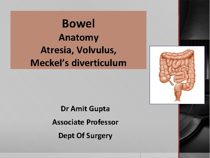 Bowel Anatomy Atresia, Volvulus, Meckel’s diverticulum Dr Amit Gupta Associate Professor Dept Of Surgery