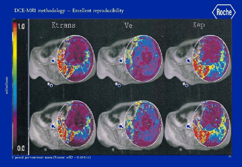 ml/ml/min DCE-MRI methodology – Excellent reproducibility 2 paired pre-treatment scans (Ktrans: w. SD ~