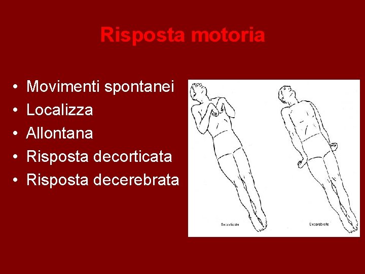 Risposta motoria • • • Movimenti spontanei Localizza Allontana Risposta decorticata Risposta decerebrata 