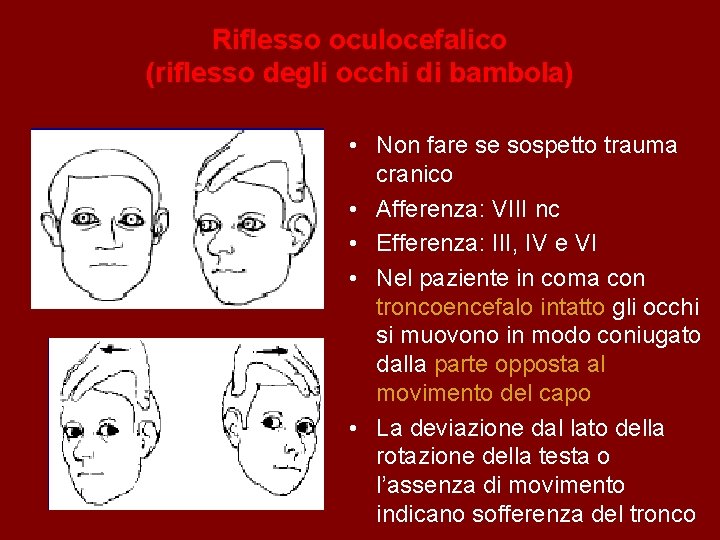 Riflesso oculocefalico (riflesso degli occhi di bambola) • Non fare se sospetto trauma cranico