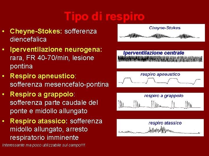Tipo di respiro • Cheyne-Stokes: sofferenza diencefalica • Iperventilazione neurogena: rara, FR 40 -70/min,