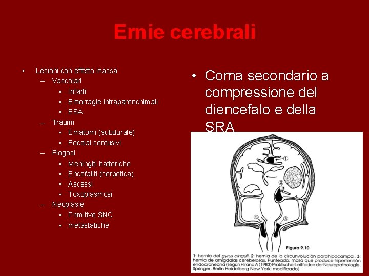 Ernie cerebrali • Lesioni con effetto massa – Vascolari • Infarti • Emorragie intraparenchimali