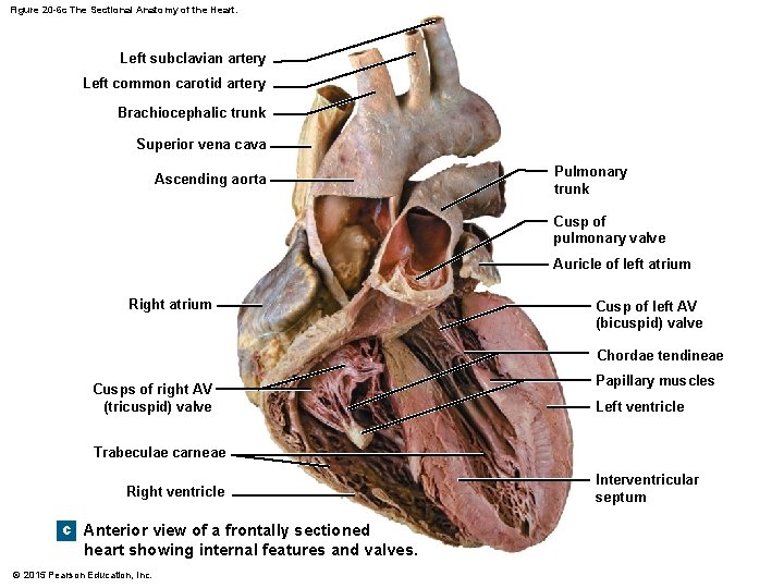 Figure 20 -6 c The Sectional Anatomy of the Heart. Left subclavian artery Left