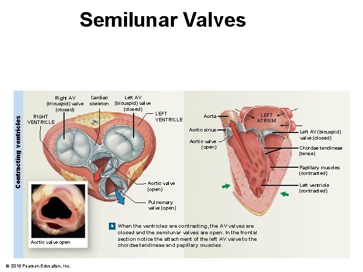 Contracting ventricles Semilunar Valves Right AV (tricuspid) valve (closed) RIGHT VENTRICLE Cardiac skeleton Left