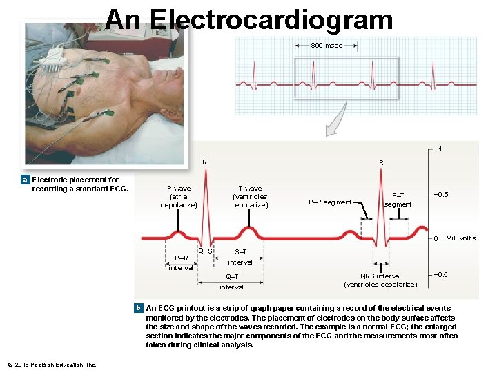 An Electrocardiogram 800 msec +1 R R a Electrode placement for recording a standard