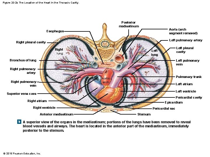 Figure 20 -2 b The Location of the Heart in the Thoracic Cavity. Posterior