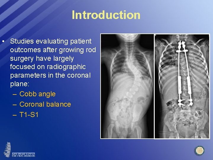 Introduction • Studies evaluating patient outcomes after growing rod surgery have largely focused on