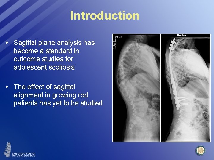 Introduction • Sagittal plane analysis has become a standard in outcome studies for adolescent