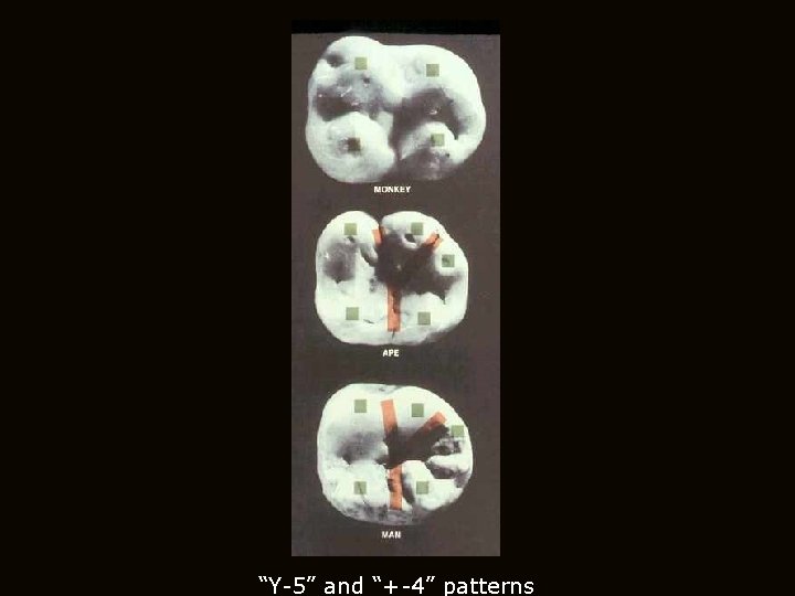 “Y-5” and “+-4” patterns “Y-5” and “+-4” patterns