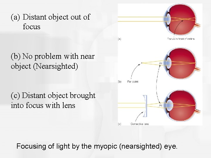 (a) Distant object out of focus (b) No problem with near object (Nearsighted) (c)