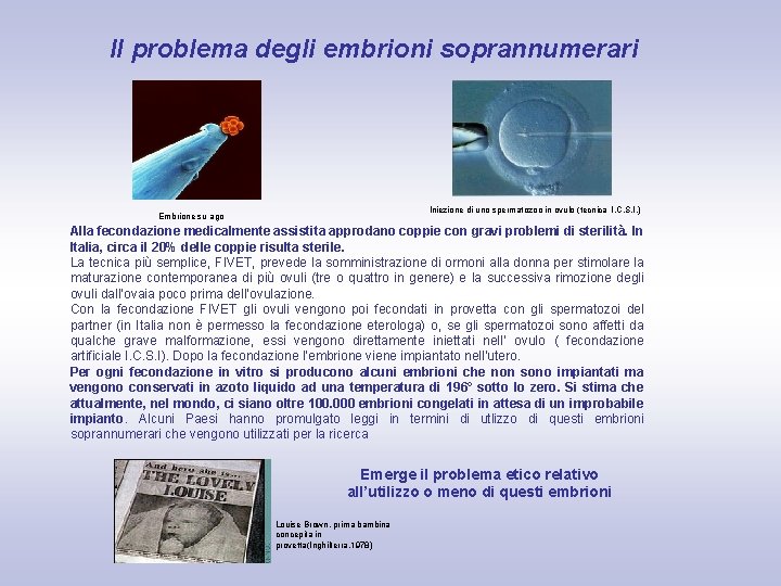 Il problema degli embrioni soprannumerari Iniezione di uno spermatozoo in ovulo (tecnica I. C.