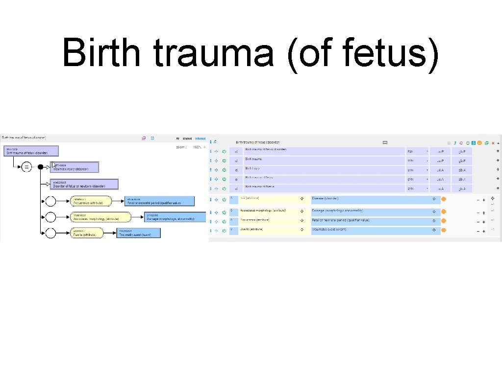 Birth trauma (of fetus) 