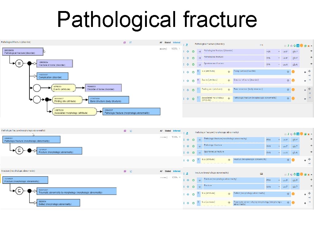 Pathological fracture 