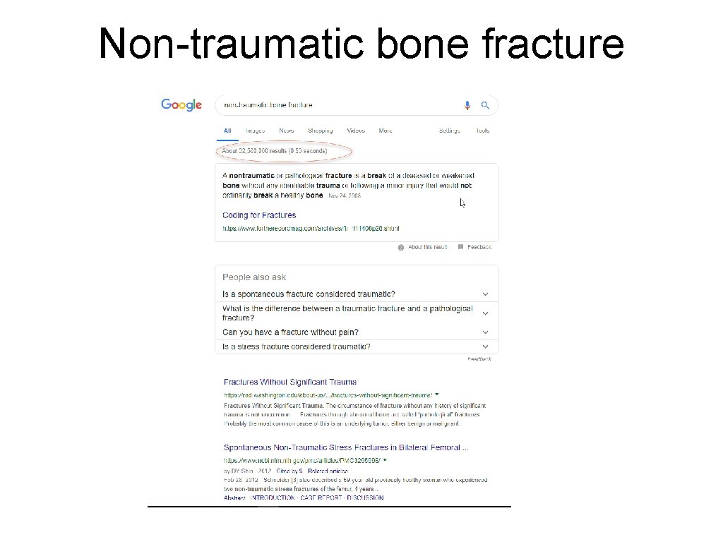 Non-traumatic bone fracture 