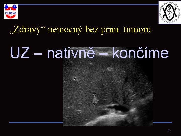 „Zdravý“ nemocný bez prim. tumoru UZ – nativně – končíme 26 