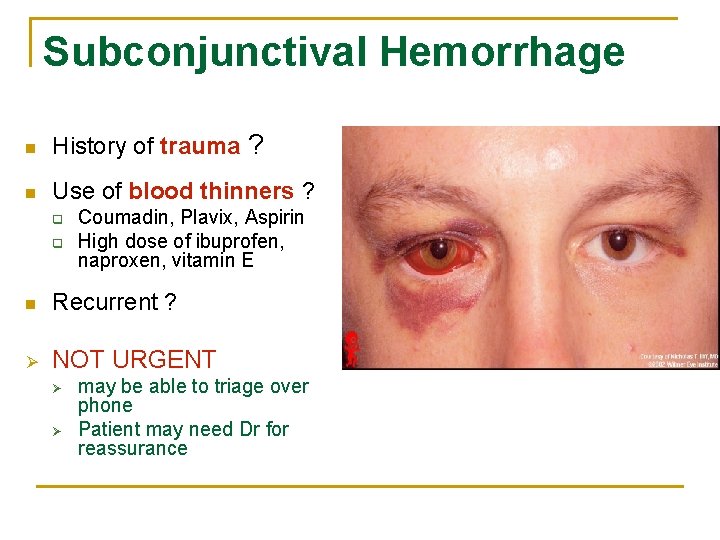 Subconjunctival Hemorrhage n History of trauma ? n Use of blood thinners ? q