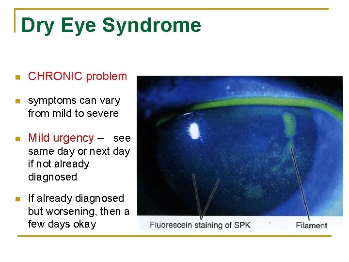 Dry Eye Syndrome n CHRONIC problem n symptoms can vary from mild to severe