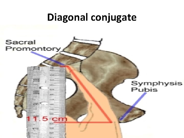 Diagonal conjugate 