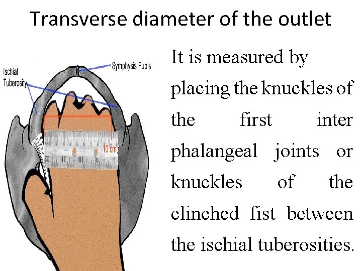 Transverse diameter of the outlet It is measured by placing the knuckles of the