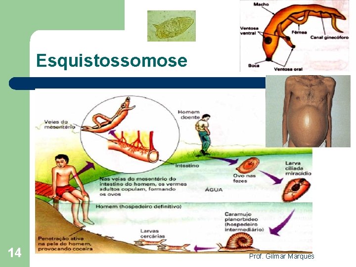 Esquistossomose 14 Prof. Gilmar Marques 