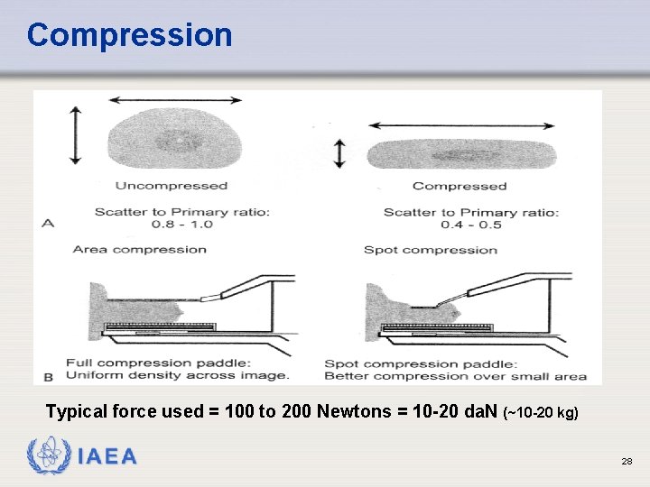 Compression Typical force used = 100 to 200 Newtons = 10 -20 da. N Compression Typical force used = 100 to 200 Newtons = 10 -20 da. N