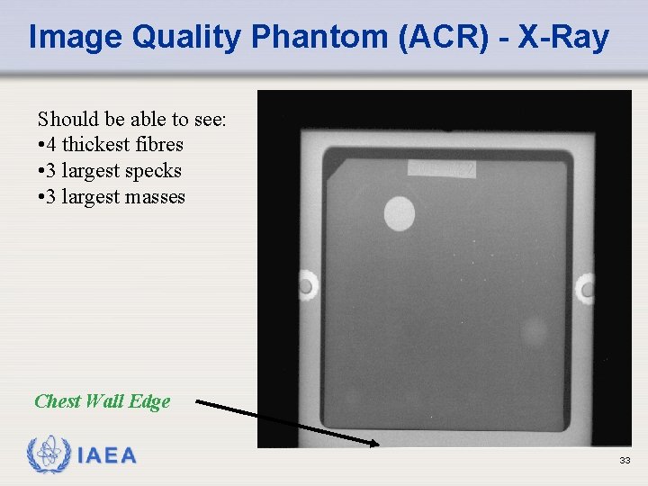 Image Quality Phantom (ACR) - X-Ray Should be able to see: • 4 thickest Image Quality Phantom (ACR) - X-Ray Should be able to see: • 4 thickest