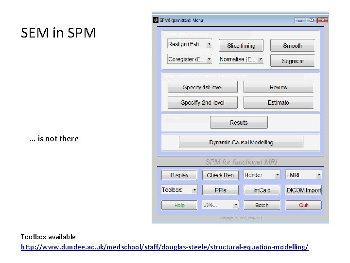 SEM in SPM … is not there Toolbox available http: //www. dundee. ac. uk/medschool/staff/douglas-steele/structural-equation-modelling/